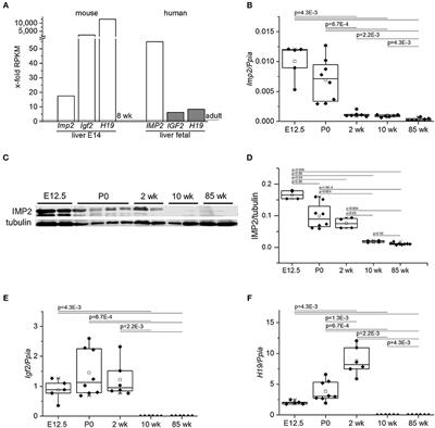 IGF2 mRNA Binding Protein 2 Transgenic Mice Are More Prone to Develop a Ductular Reaction and to Progress Toward Cirrhosis